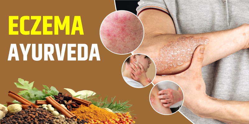 eczema-ayurveda